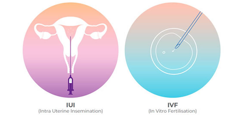 IUI & IVF